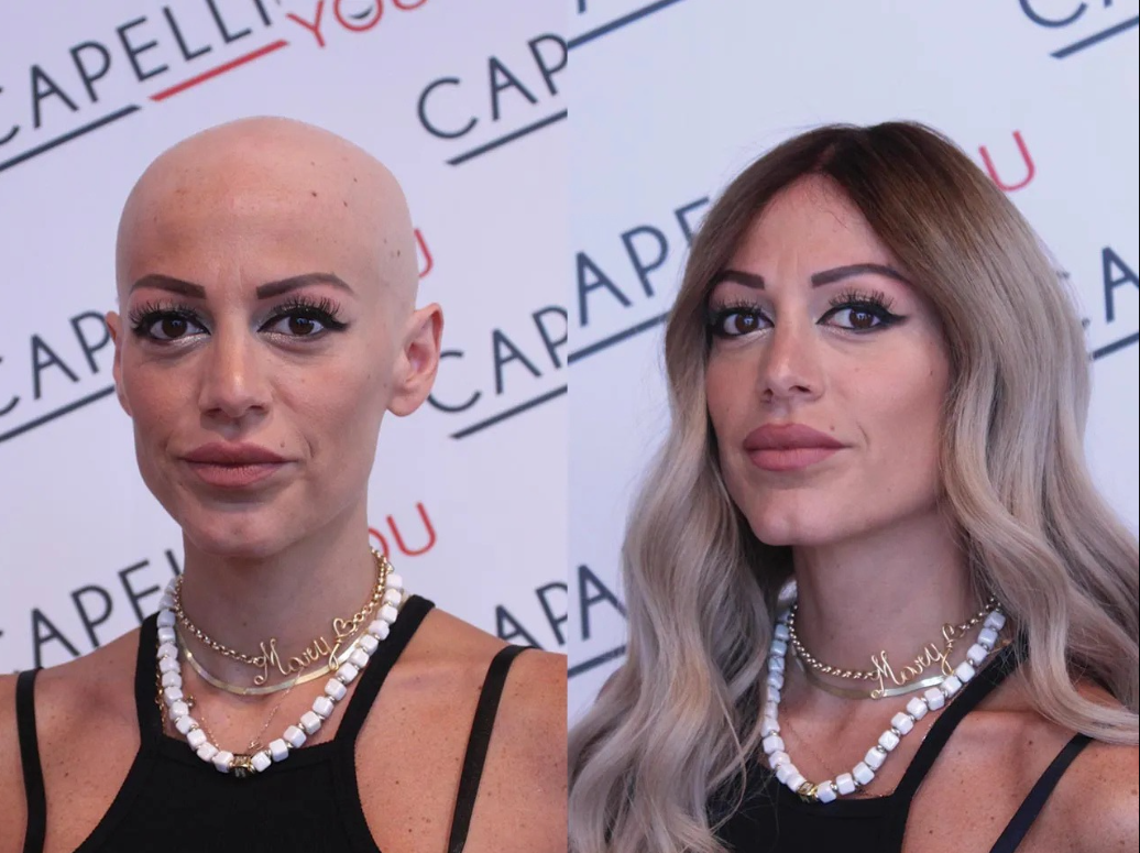 Prima / Dopo